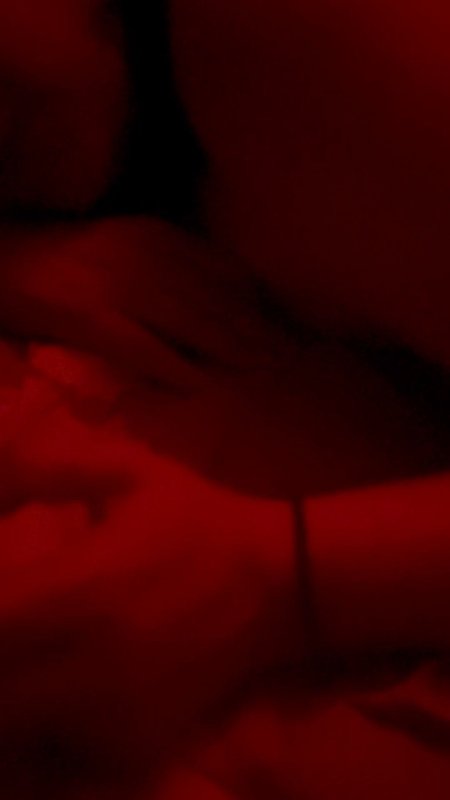 treatment for boils on anus — macylacy Nude Leaked OnlyFans Photo - 9:53