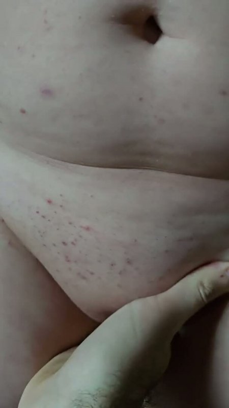 Mandyand Scarlet adult braces providence — adult porn video, 10:12