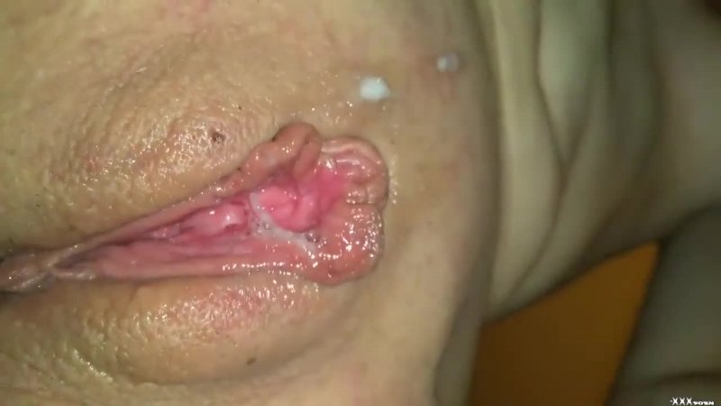 vulva sore